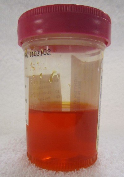 800px pyridiumurine 16