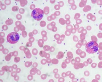 eosinophils 12