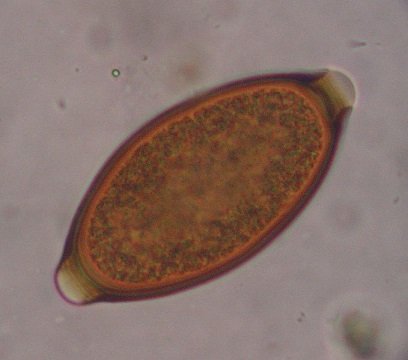 eggj 11