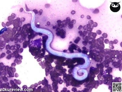 CanineBloodMicrofilaria50XSMALLSethChapman 5