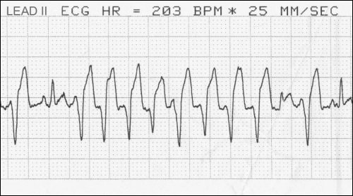 Dog ECG post GDV 73