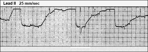 ECG dog wierd baseline 118