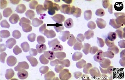 eqbldsm16.20small 125