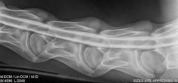 myelogram0003.cropped 119